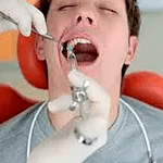 Dentista Dr Tiago Spanazzi Clareamento Dentistica